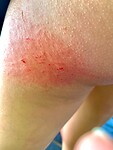 IMG_0995
