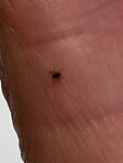 BB3B0ABF-D5D6-4317-990D-34FFB4226EAE