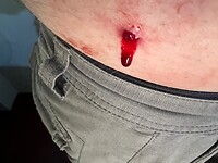 Bloedzuiger neemt een hapje van JJ