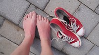 Mijn voeten zijn net zo rood als mijn schoenen