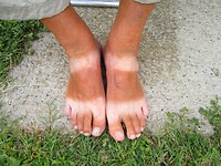 Frank 's nieuwe sandalen