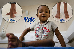 Rajo before and after