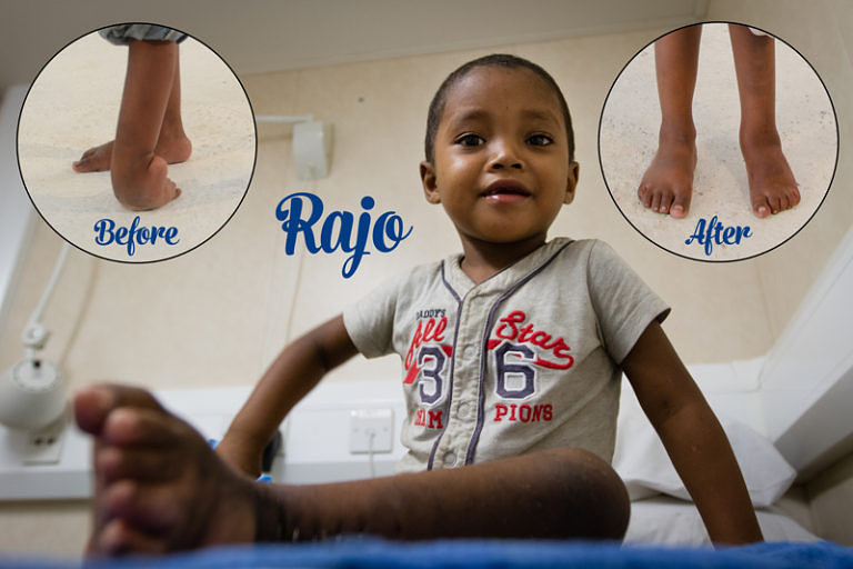 Rajo before and after