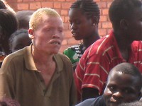 albino drummer bij dank-dans voor borehole