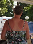 Ik moet op veel plekken nog wat bijkleuren voordat ik mijn bikini aan kan