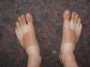 What's wrong with my feet?