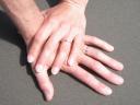 De ringen