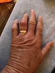 Mijn hand is nog steeds opgezet en gevoelig😔
