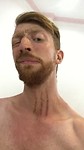 Local cough treatment