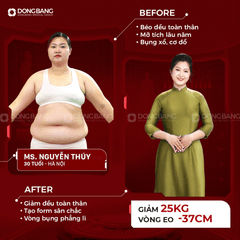 Giảm béo liệu pháp cao