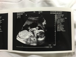 Guess B. sprout's Stats — A Baby Pool on Baby Bookie