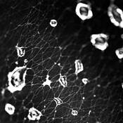 Web and Drops by Art Braitman