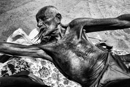 Vitamin D Therapy by Michael Ernest Sweet