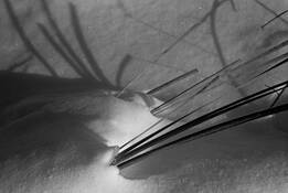 Fronds by Charlie Lemay