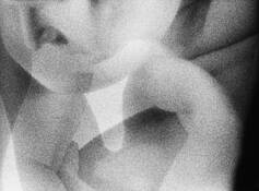 Observing Figure by Chris Maitzen