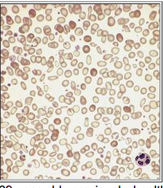 U2-Robbins-C14: RBC & Bleeding Disorders Flashcards by Onecia Hannibal ...