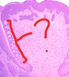 Q image thumb