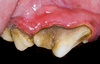 A image thumb