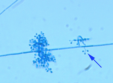 Mycology Flashcards in Claire Chiz's M(ASCP) Prep Collection