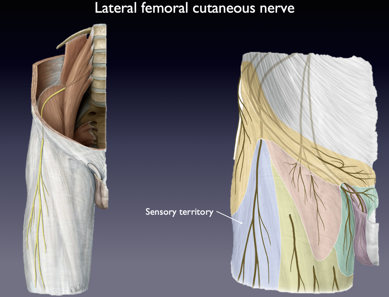 Lateral Femoral Cutaneous Nerve Cadaver