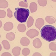 Pathology: Heme