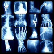 Orthopedics