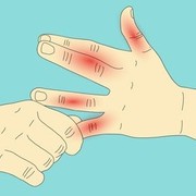 Rheumatology