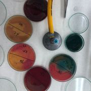 Microbiología unidad II