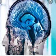 Neurologia