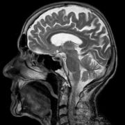 Neuro