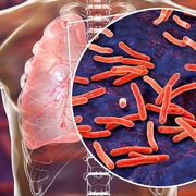 Antimicobacterianos