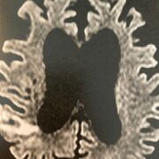 Neurology