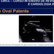 Hemodinâmica Anatomia E história