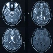 CNS