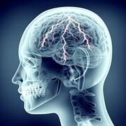 Pathologies neurologiques