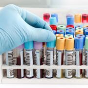Misan: Y5| Chem Path MISAN