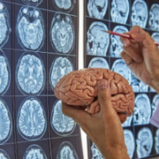 neurocirurgia monitoria