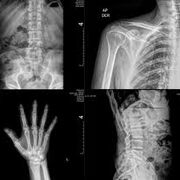 Radiología