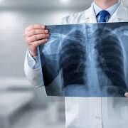 RADIOLOGIA