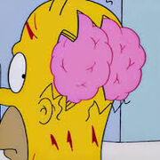 Year 4 Neurology