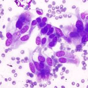Pathology