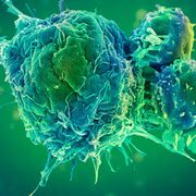 Oncology