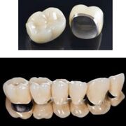 Dental Materials