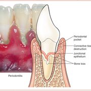 Periodontics