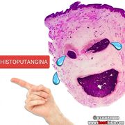 HISTOPATHOLOGY