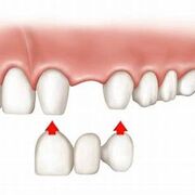 Prosthodontics