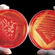 Microbiologia