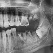 DEN 112 - Dental Radiography
