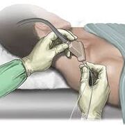 Principles of Anesthesia II