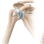 Chirurgie (Physiotherapie)